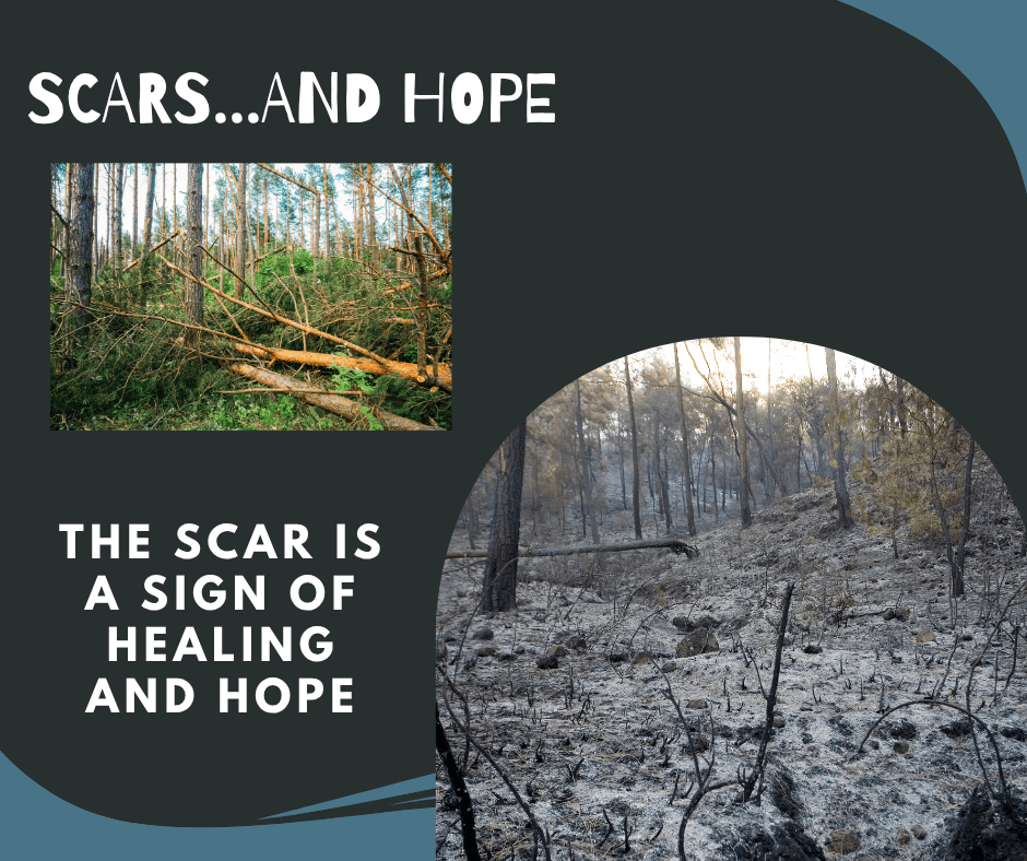 Scars…And Hope